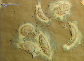 human_endothelial_cells_right